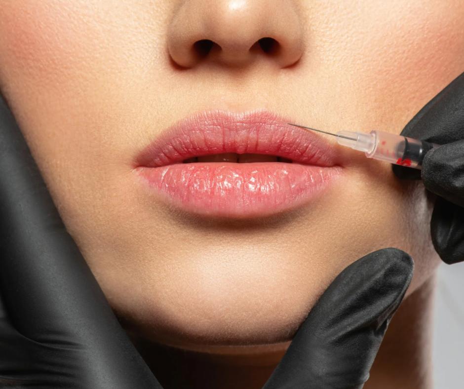 Traitement par injections d'acide hyaluronique