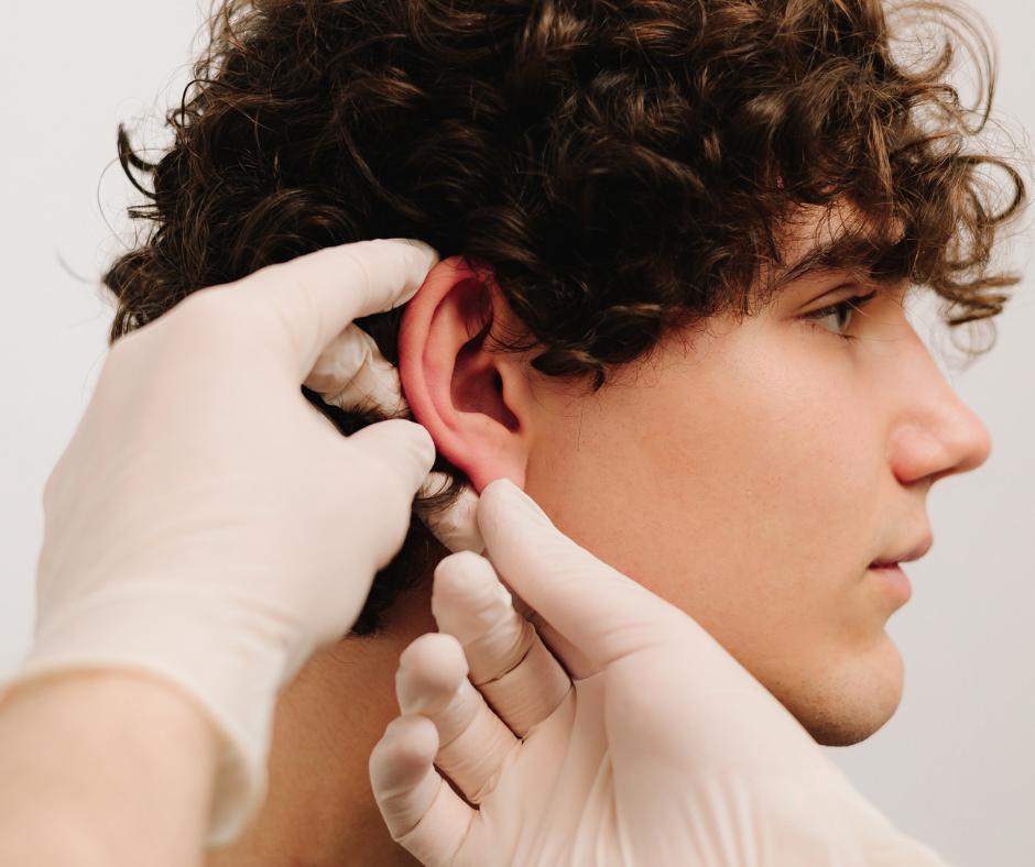 Otoplastie résultat